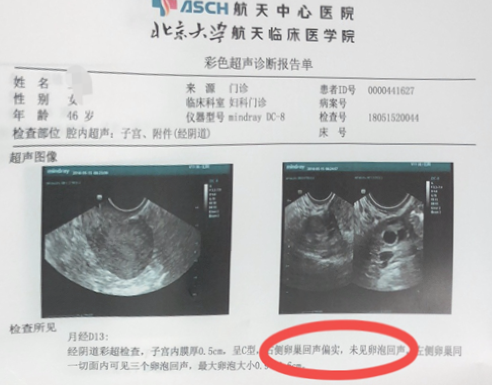 1700620035143359.png 640.png