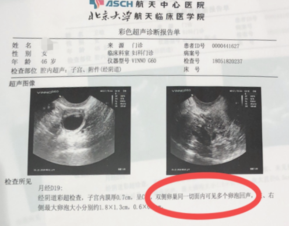 1700620062206556.png 640 (1).png