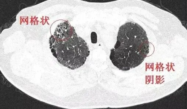 1717039520191626.png 1716975921362.png